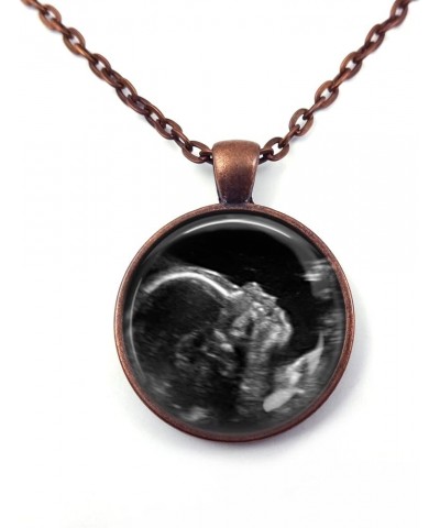 Custom Photo Ultrasound Necklace or Key Chain - Personalized Picture Jewelry - Sonogram Pendant - Birth Announcement Jewelry ...