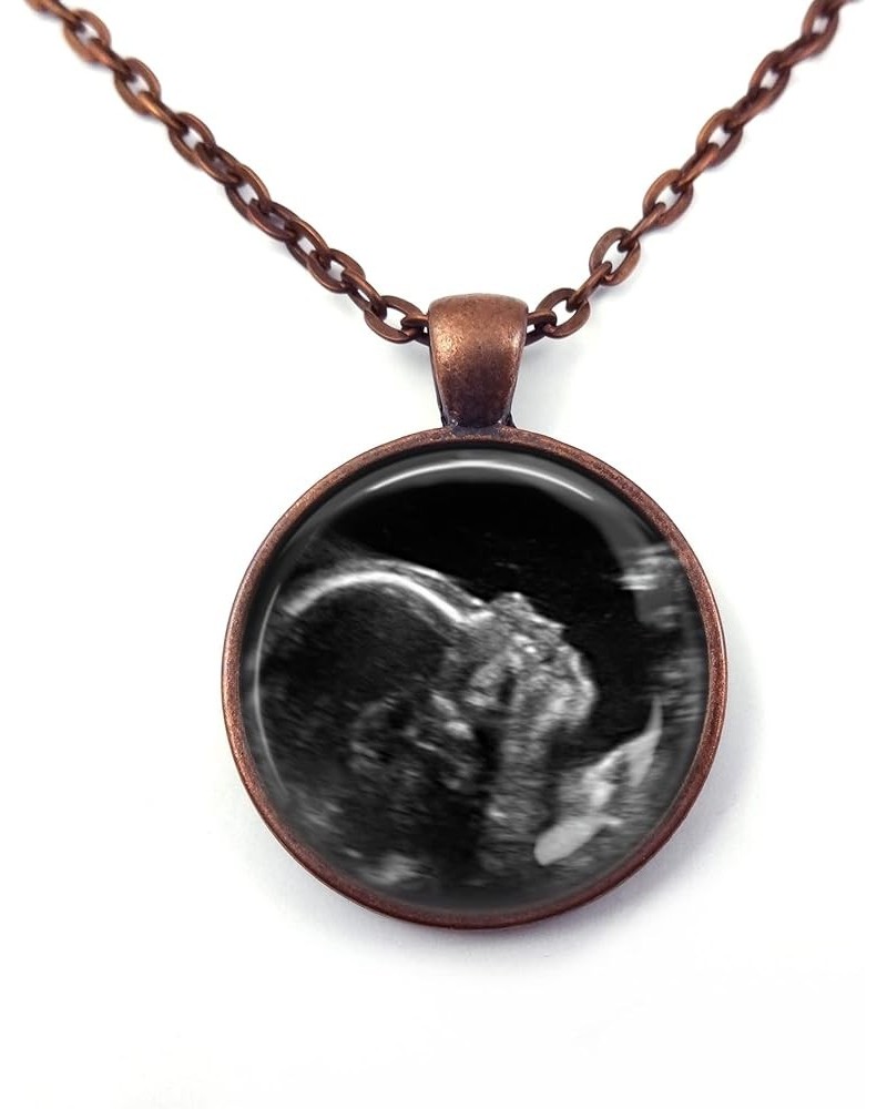 Custom Photo Ultrasound Necklace or Key Chain - Personalized Picture Jewelry - Sonogram Pendant - Birth Announcement Jewelry ...